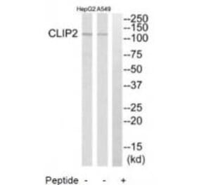 Western blot - CLIP2 Antibody from Signalway Antibody (34530) - Antibodies.com