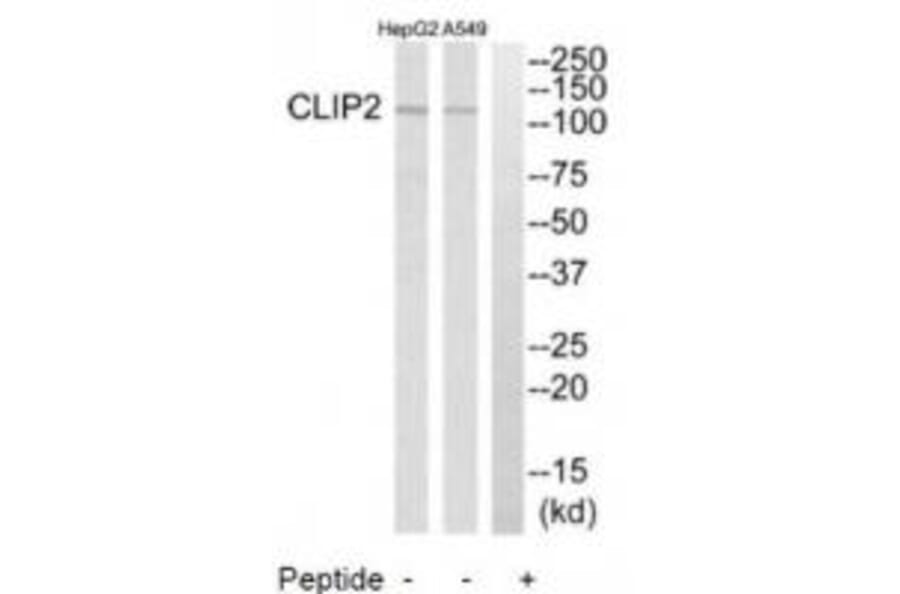 Western blot - CLIP2 Antibody from Signalway Antibody (34530) - Antibodies.com