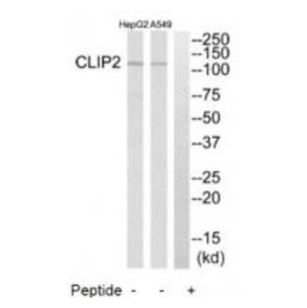 Western blot - CLIP2 Antibody from Signalway Antibody (34530) - Antibodies.com