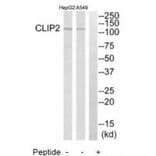 Western blot - CLIP2 Antibody from Signalway Antibody (34530) - Antibodies.com