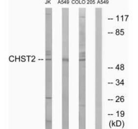Western blot - CHST2 Antibody from Signalway Antibody (34534) - Antibodies.com