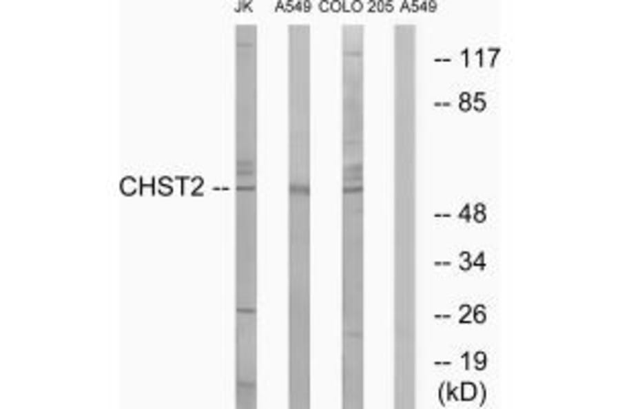 Western blot - CHST2 Antibody from Signalway Antibody (34534) - Antibodies.com