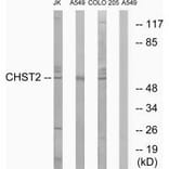 Western blot - CHST2 Antibody from Signalway Antibody (34534) - Antibodies.com