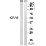 Western blot - CPA5 Antibody from Signalway Antibody (34547) - Antibodies.com