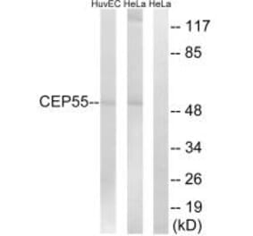 Western blot - CEP55 Antibody from Signalway Antibody (34566) - Antibodies.com