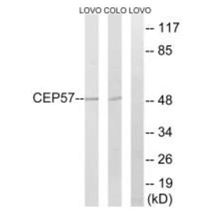 Western blot - CEP57 Antibody from Signalway Antibody (34567) - Antibodies.com