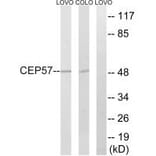 Western blot - CEP57 Antibody from Signalway Antibody (34567) - Antibodies.com