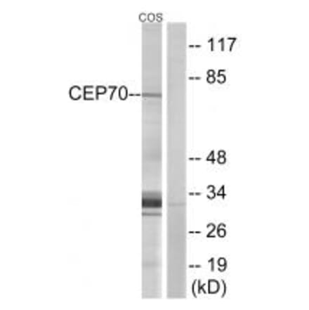 Western blot - CEP70 Antibody from Signalway Antibody (34568) - Antibodies.com