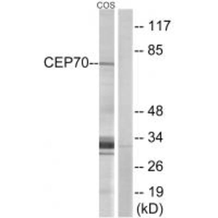 Western blot - CEP70 Antibody from Signalway Antibody (34568) - Antibodies.com