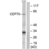 Western blot - CEP70 Antibody from Signalway Antibody (34568) - Antibodies.com