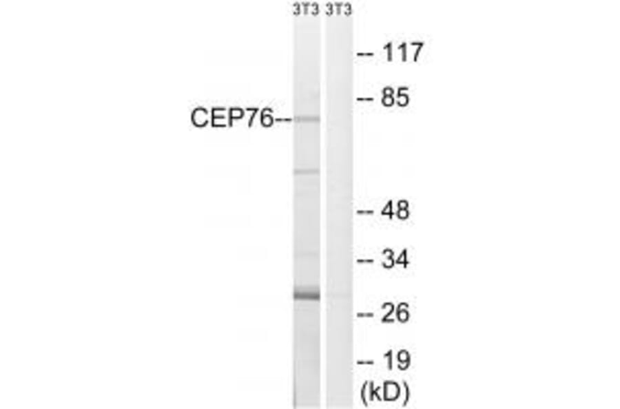 Western blot - CEP76 Antibody from Signalway Antibody (34569) - Antibodies.com