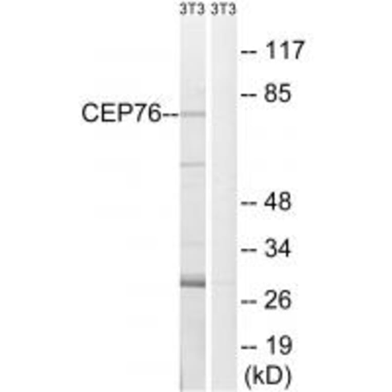 Western blot - CEP76 Antibody from Signalway Antibody (34569) - Antibodies.com