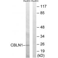 Western blot analysis of extracts from HUVEC cells, using CBLN1 antibody #34570.