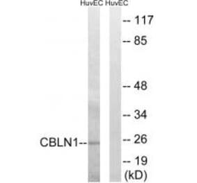 Western blot - CBLN1 Antibody from Signalway Antibody (34570) - Antibodies.com