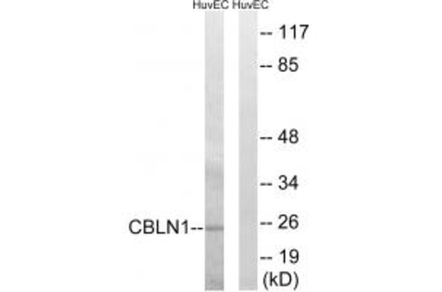Western blot - CBLN1 Antibody from Signalway Antibody (34570) - Antibodies.com