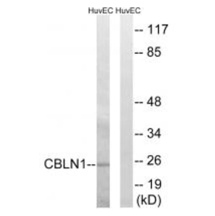 Western blot - CBLN1 Antibody from Signalway Antibody (34570) - Antibodies.com