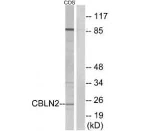 Western blot - CBLN2 Antibody from Signalway Antibody (34571) - Antibodies.com
