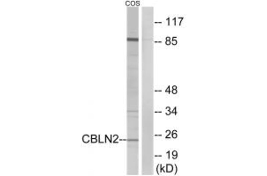 Western blot - CBLN2 Antibody from Signalway Antibody (34571) - Antibodies.com