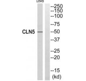 Western blot - CLN5 Antibody from Signalway Antibody (34575) - Antibodies.com