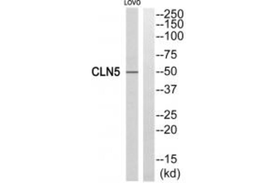 Western blot - CLN5 Antibody from Signalway Antibody (34575) - Antibodies.com