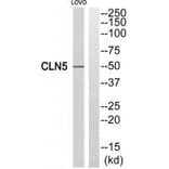 Western blot - CLN5 Antibody from Signalway Antibody (34575) - Antibodies.com