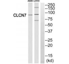 Western blot - CLCN7 Antibody from Signalway Antibody (34580) - Antibodies.com