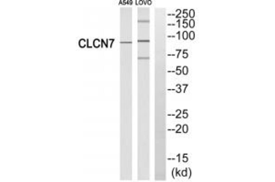 Western blot - CLCN7 Antibody from Signalway Antibody (34580) - Antibodies.com