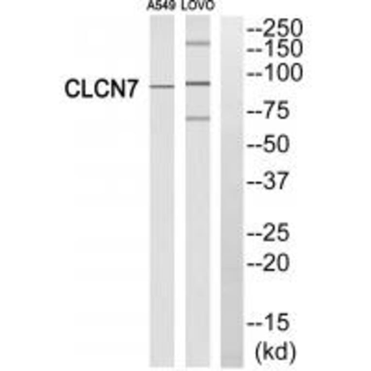 Western blot - CLCN7 Antibody from Signalway Antibody (34580) - Antibodies.com