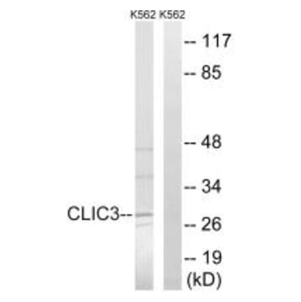 Western blot - CLIC3 Antibody from Signalway Antibody (34583) - Antibodies.com