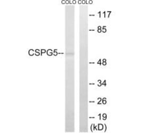 Western blot - CSPG5 Antibody from Signalway Antibody (34587) - Antibodies.com