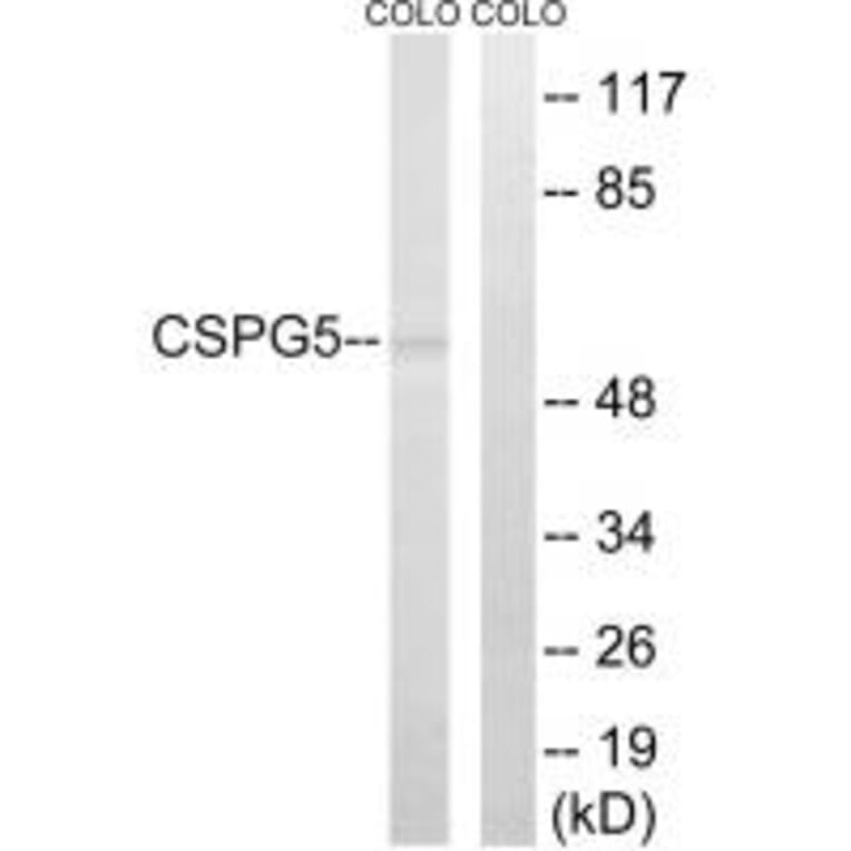 Western blot - CSPG5 Antibody from Signalway Antibody (34587) - Antibodies.com