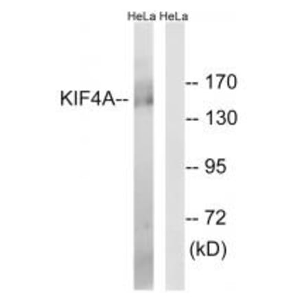 Western blot - KIF4A Antibody from Signalway Antibody (34591) - Antibodies.com