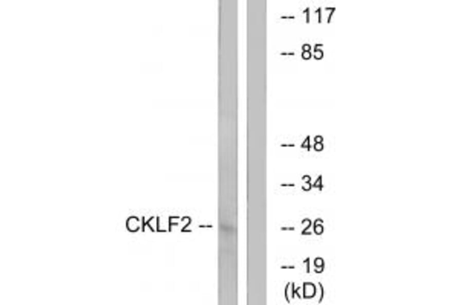 Western blot - CKLF2 Antibody from Signalway Antibody (34593) - Antibodies.com
