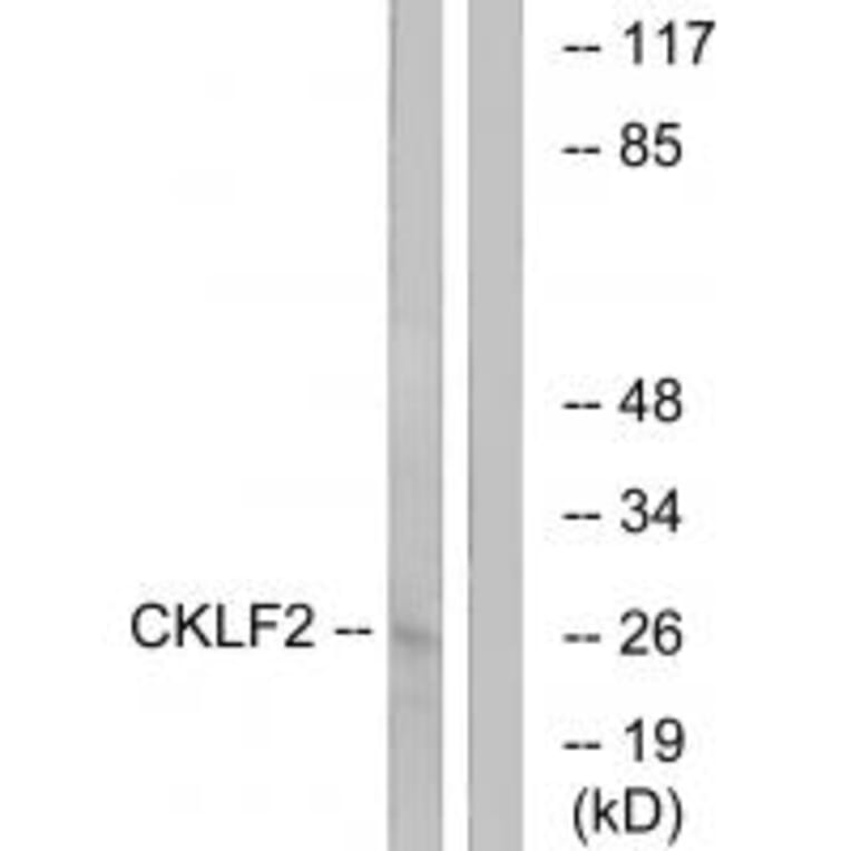 Western blot - CKLF2 Antibody from Signalway Antibody (34593) - Antibodies.com