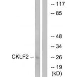 Western blot - CKLF2 Antibody from Signalway Antibody (34593) - Antibodies.com