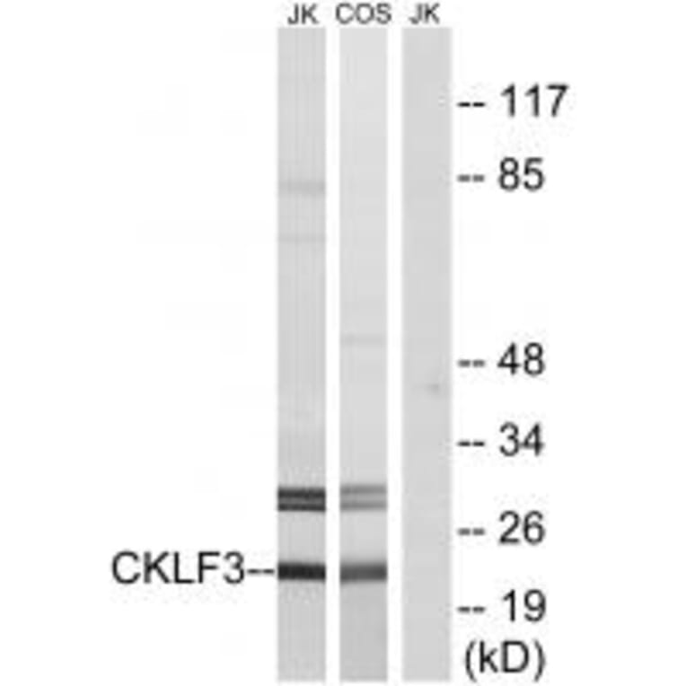 Western blot - CKLF3 Antibody from Signalway Antibody (34594) - Antibodies.com