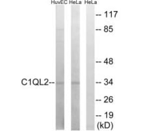 Western blot - C1QL2 Antibody from Signalway Antibody (34609) - Antibodies.com