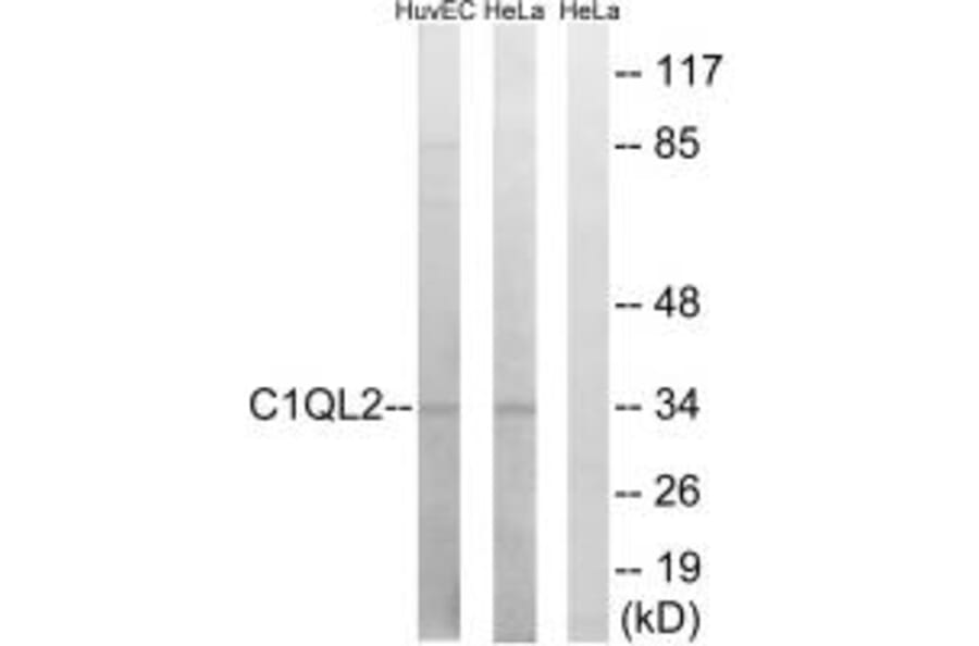 Western blot - C1QL2 Antibody from Signalway Antibody (34609) - Antibodies.com