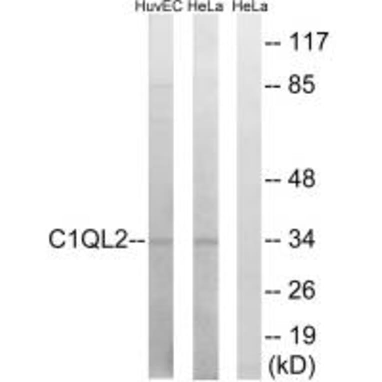 Western blot - C1QL2 Antibody from Signalway Antibody (34609) - Antibodies.com