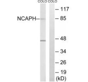 Western blot - NCAPH Antibody from Signalway Antibody (34615) - Antibodies.com