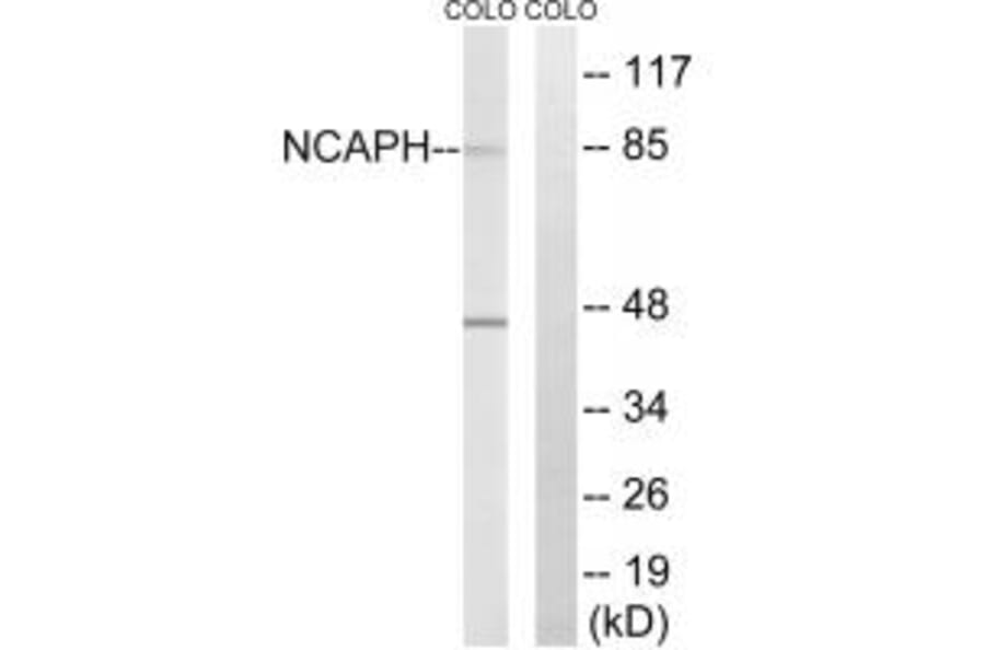 Western blot - NCAPH Antibody from Signalway Antibody (34615) - Antibodies.com