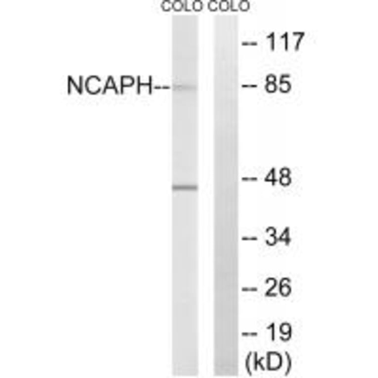 Western blot - NCAPH Antibody from Signalway Antibody (34615) - Antibodies.com