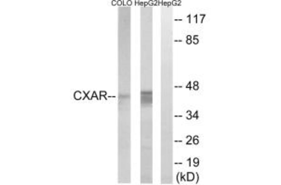 Western blot - CXADR Antibody from Signalway Antibody (34624) - Antibodies.com