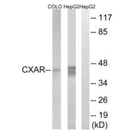 Western blot - CXADR Antibody from Signalway Antibody (34624) - Antibodies.com