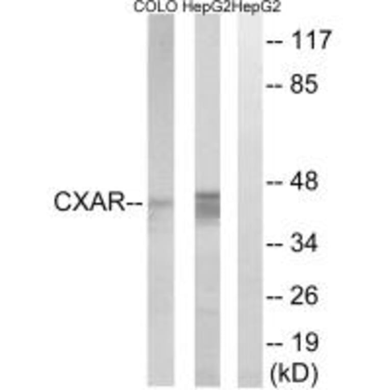 Western blot - CXADR Antibody from Signalway Antibody (34624) - Antibodies.com