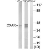 Western blot - CXADR Antibody from Signalway Antibody (34624) - Antibodies.com