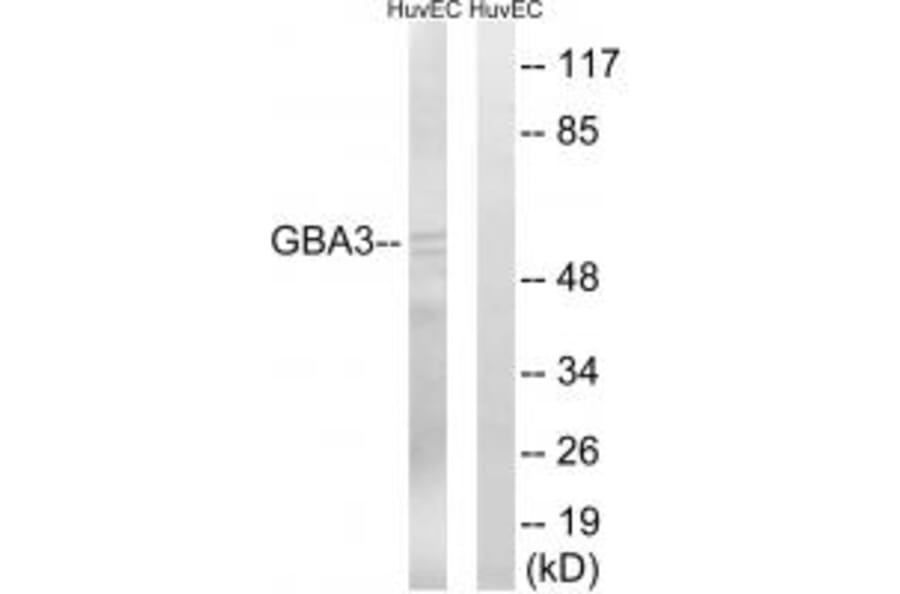 Western blot - GBA3 Antibody from Signalway Antibody (34636) - Antibodies.com