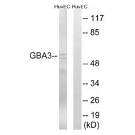 Western blot - GBA3 Antibody from Signalway Antibody (34636) - Antibodies.com