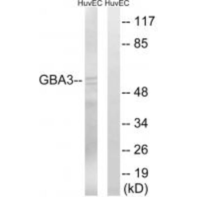 Western blot - GBA3 Antibody from Signalway Antibody (34636) - Antibodies.com