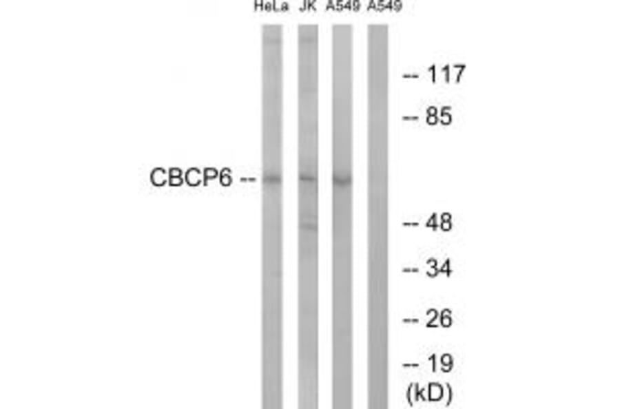 Western blot - CBCP6 Antibody from Signalway Antibody (34638) - Antibodies.com
